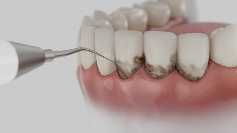 Reliable Teeth Cleaning And Checkup contractor in Walker County County, AL by Dentist Open Now